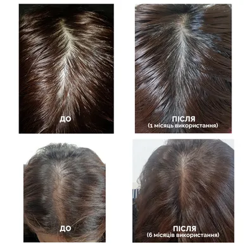 Тоник для роста волос DR.FORHAIR Folligen Tonic 120 мл