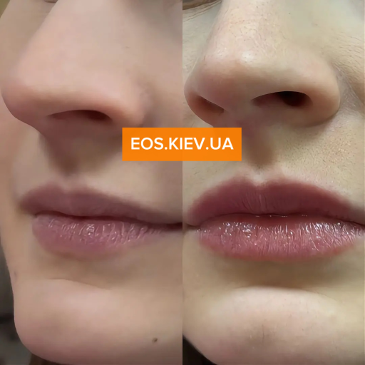 Плампер для губ с микроиглами VT COSMETICS Reedle Shot Lip Plumper Beginner 4.3 г