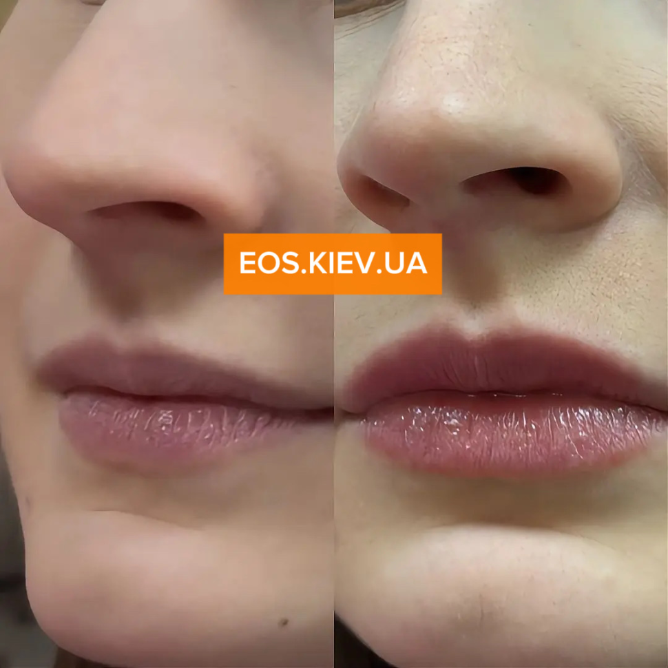 Плампер для губ с микроиглами VT COSMETICS Reedle Shot Lip Plumper Beginner 4.3 г (Цена: 395 грн.)