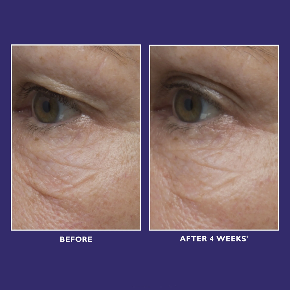 Многофункциональный крем для кожи вокруг глаз PETER THOMAS ROTH Ultimate Solution 5™ Multitasking Eye Cream 15 мл (Цена: 1 950 грн.)
