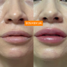 VT COSMETICS інтенсивний плампер для губ з мікроголками Reedle Shot Lip Plumper Expert 4.3 г (Ціна: 480 грн.)