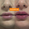 VT COSMETICS інтенсивний плампер для губ з мікроголками Reedle Shot Lip Plumper Expert 4.3 г (Ціна: 480 грн.)
