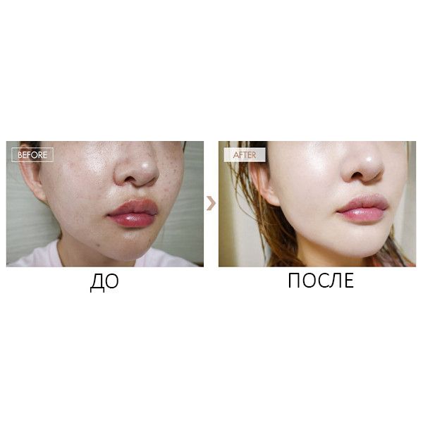 ББ-крем DR.CEURACLE стойкий с матовым финишем BB Balm Recovery SPF 28 PA ++ 45 мл (Цена: 1 485 грн.)