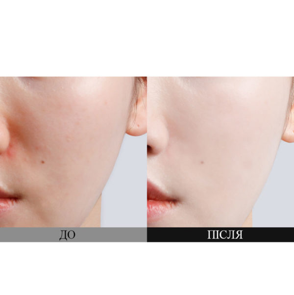 Солнцезащитный осветляющий крем с пробиотиками DR.CEURACLE Pro Balance Biotics Clear Up Sun SPF 50+ PA++++ 50 мл (Цена: 756 грн.)